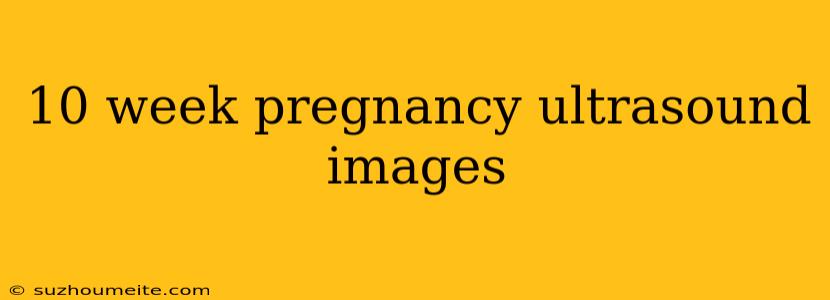 10 Week Pregnancy Ultrasound Images