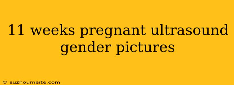 11 Weeks Pregnant Ultrasound Gender Pictures