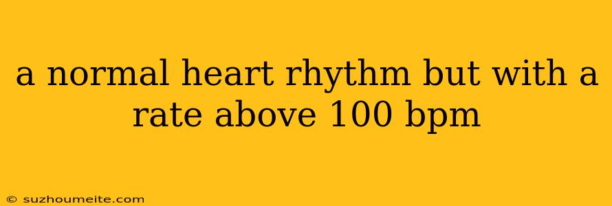 A Normal Heart Rhythm But With A Rate Above 100 Bpm