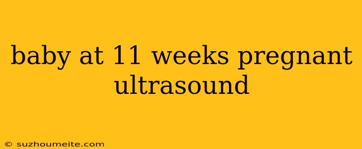 Baby At 11 Weeks Pregnant Ultrasound